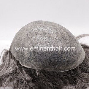Human Hair Prosthesis
