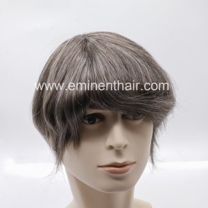 Non Surgical Hair System